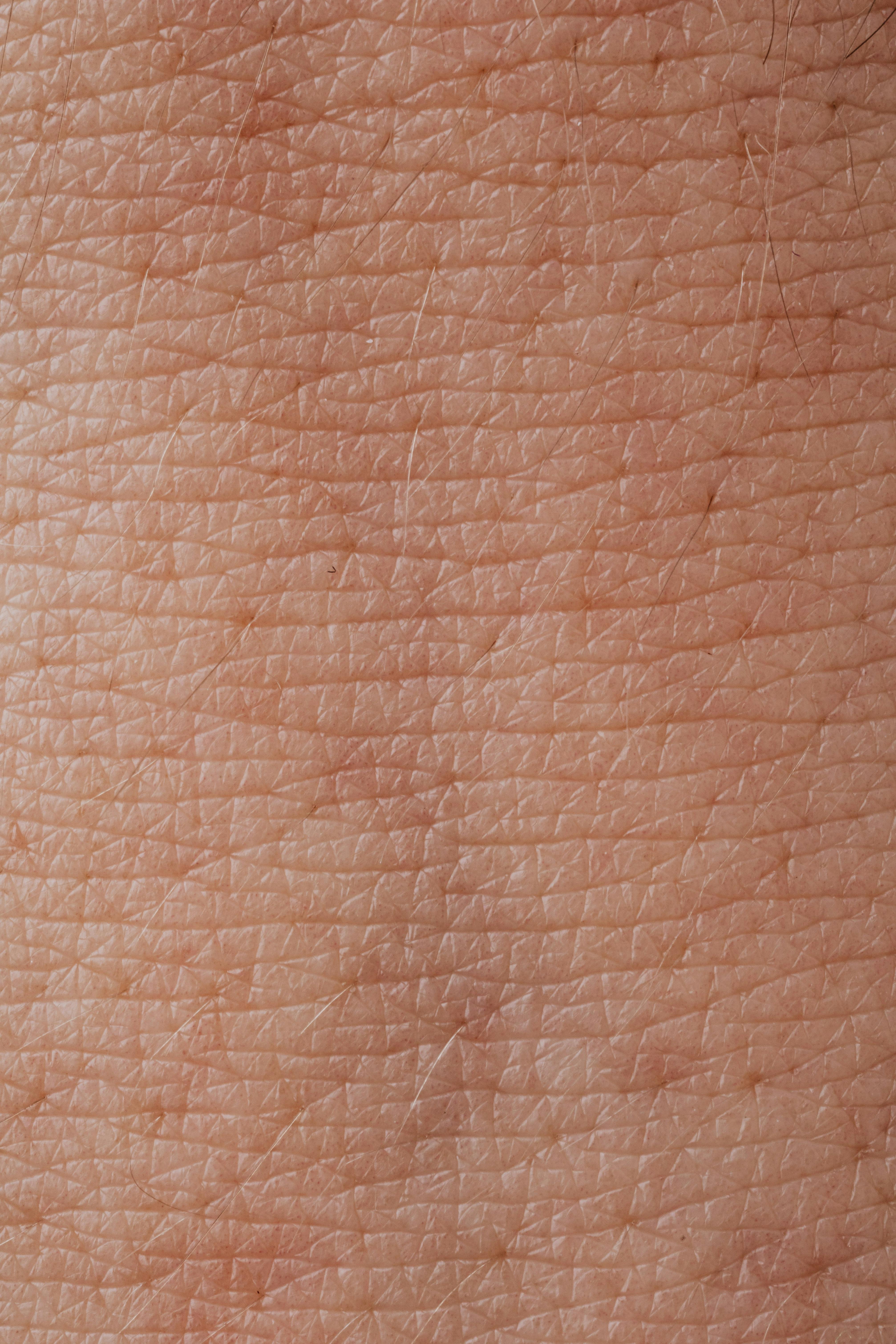 ¿Cómo eliminar las manchas en la piel?