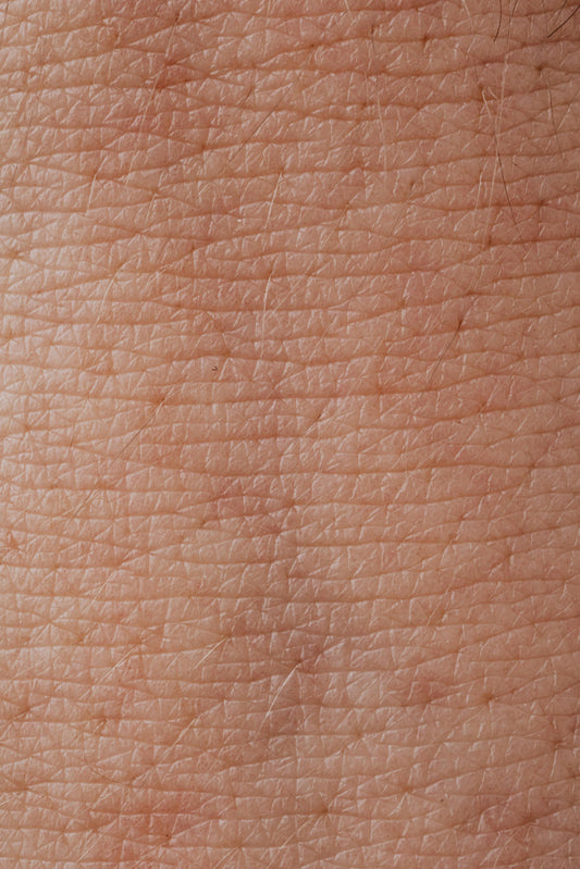 ¿Cómo eliminar las manchas en la piel?