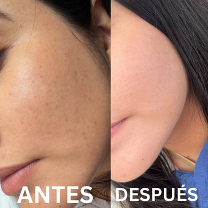 Crema Aclarante con Niacinamida y Extractos botánicos | Aclara, hidrata y reduce las manchas en tu piel