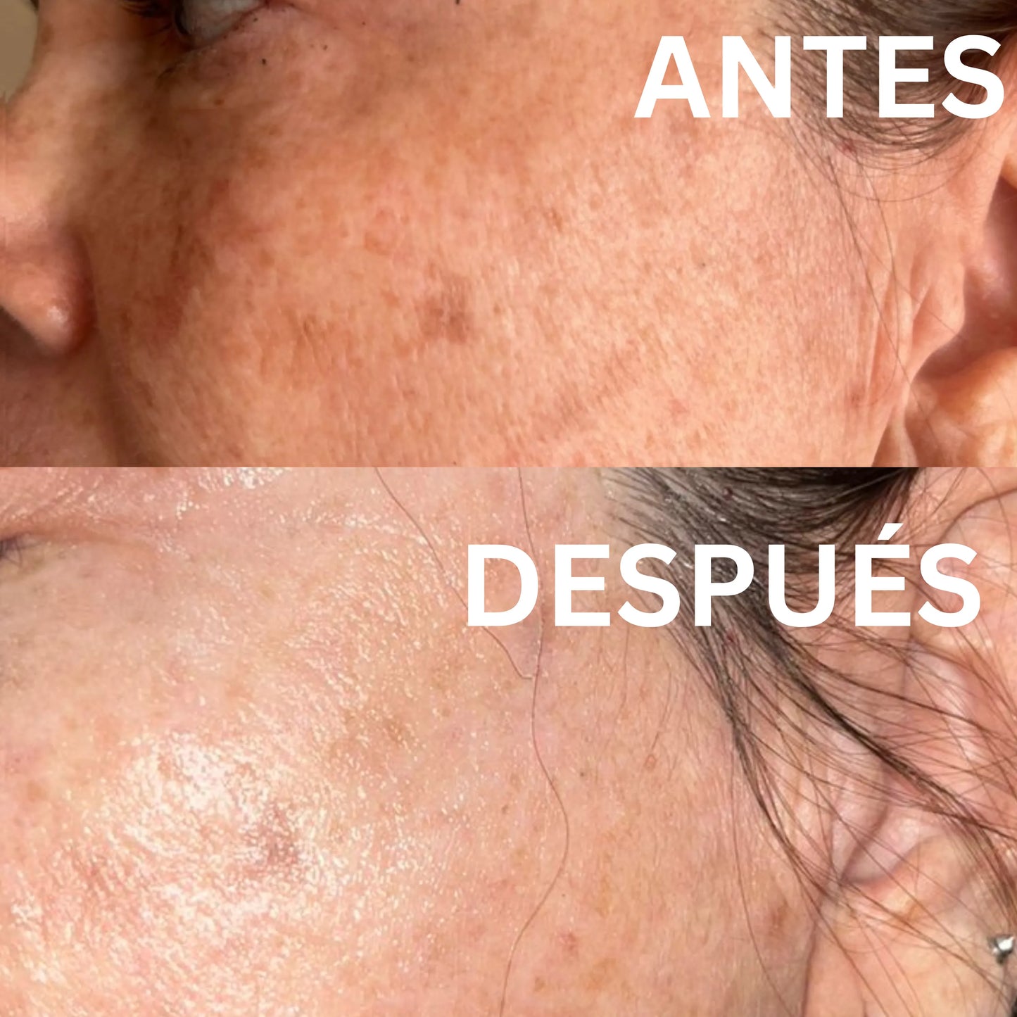 Crema Aclarante con Niacinamida y Extractos botánicos | Aclara, hidrata y reduce las manchas en tu piel