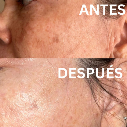 Crema Aclarante con Niacinamida y Extractos botánicos | Aclara, hidrata y reduce las manchas en tu piel