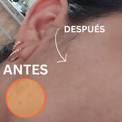 Sérum Vitamina C Estabilizada con Ácido Hialurónico | Hidrata y reduce las manchas en tu piel
