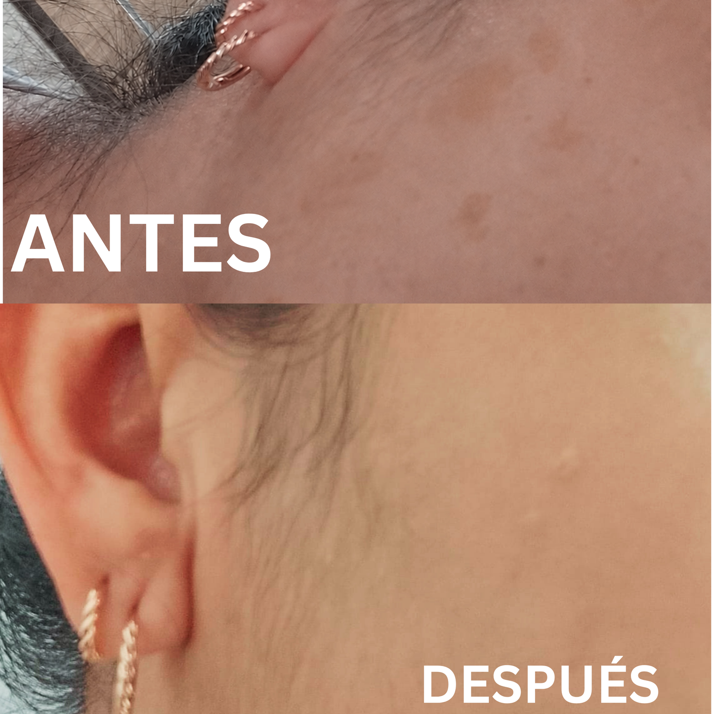 Sérum Vitamina C Estabilizada con Ácido Hialurónico | Hidrata y reduce las manchas en tu piel