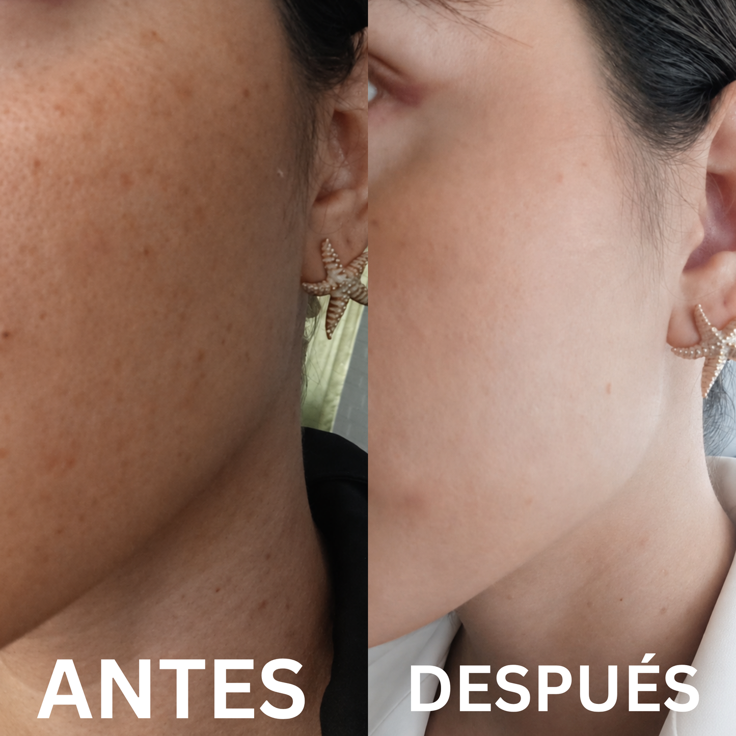 Sérum Vitamina C Estabilizada con Ácido Hialurónico | Hidrata y reduce las manchas en tu piel