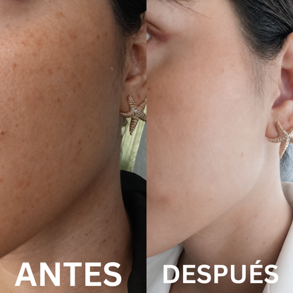 Sérum Vitamina C Estabilizada con Ácido Hialurónico | Hidrata y reduce las manchas en tu piel