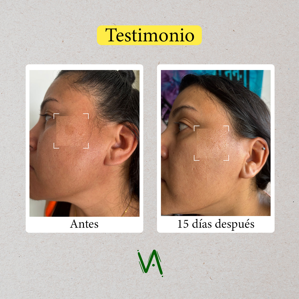 Rutina Disminución tus Manchas